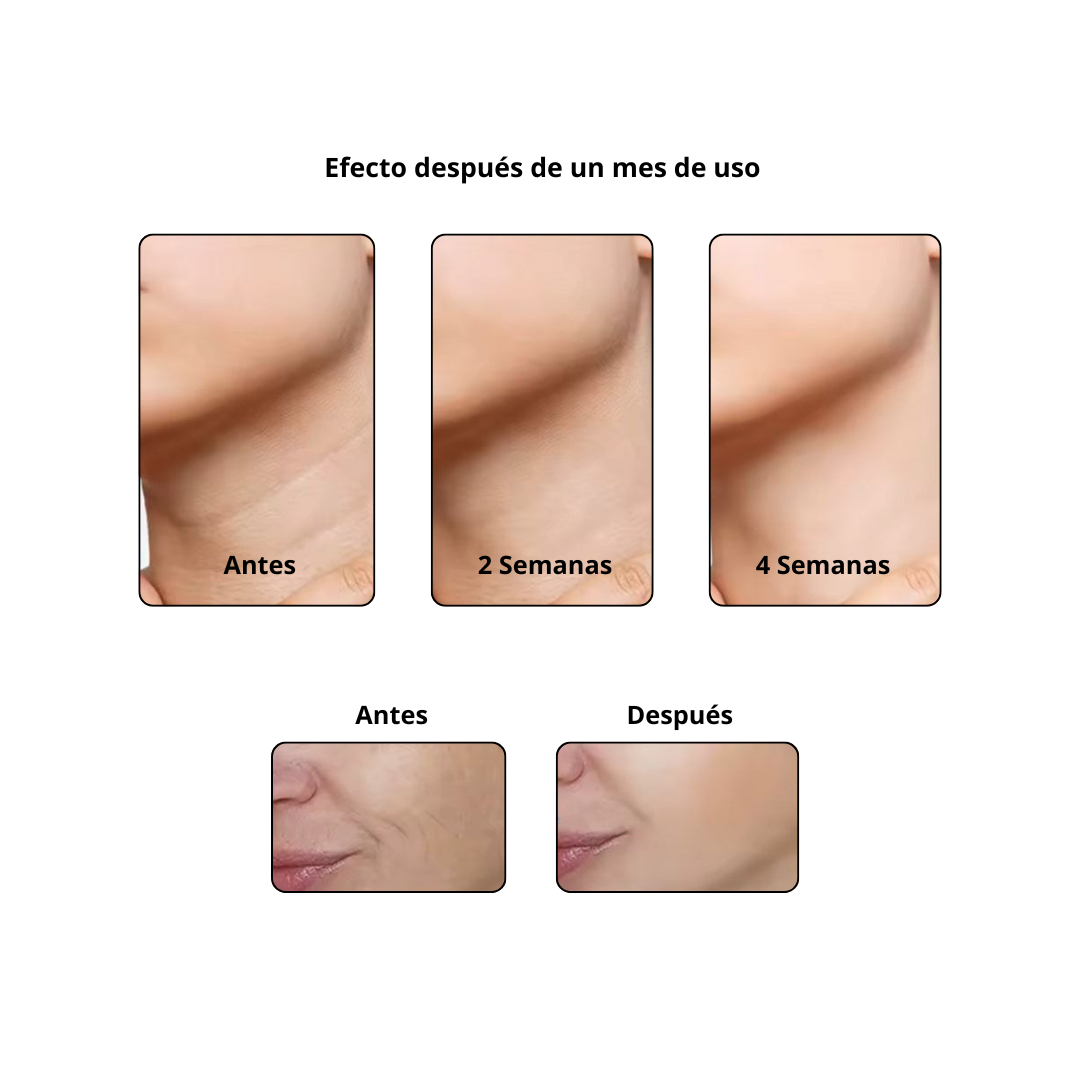 V Sculpt - Masajeador Facial