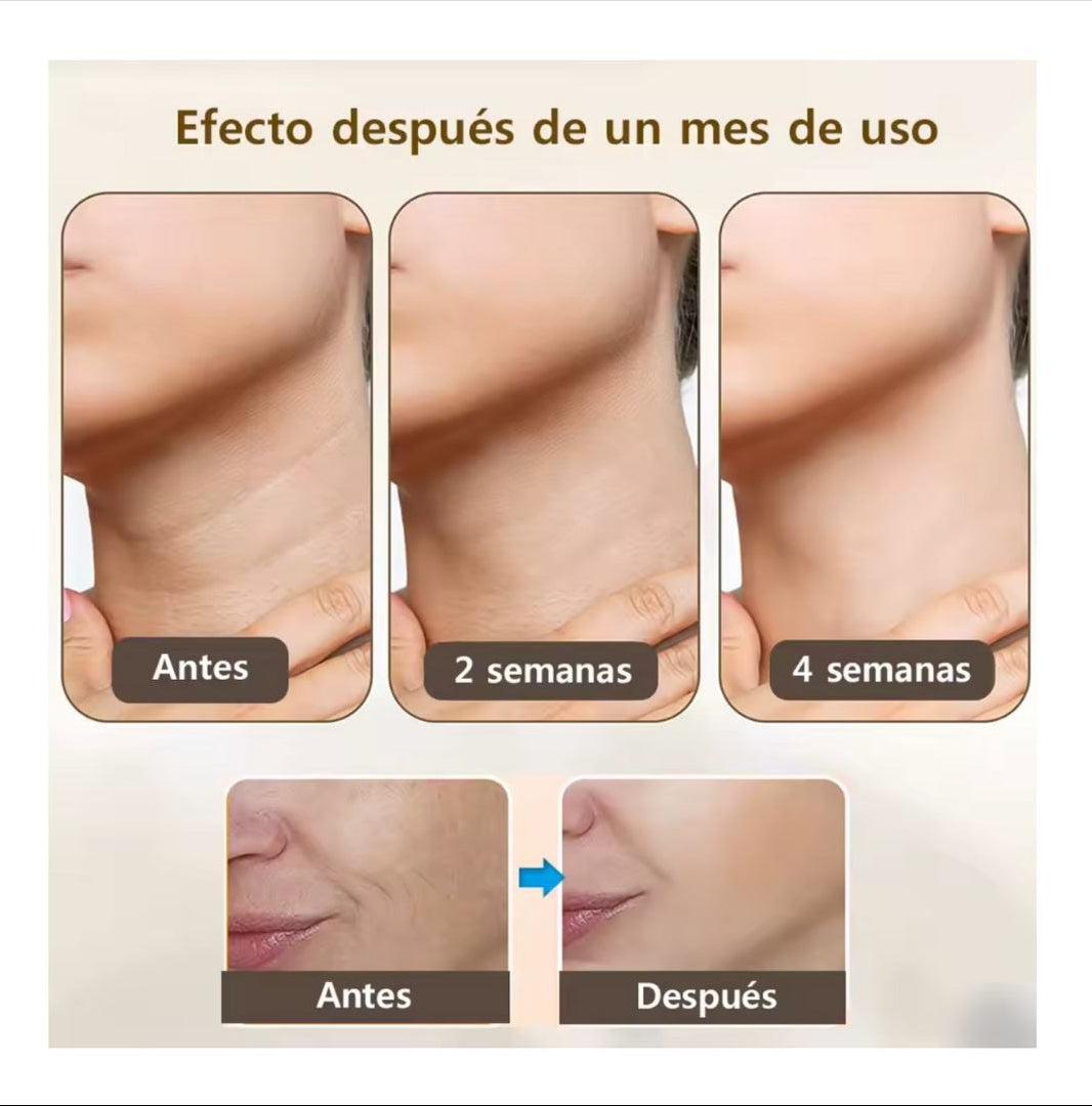 V Sculpt - Masajeador Facial