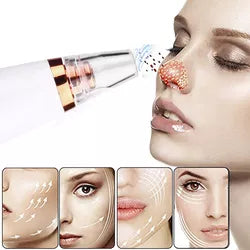 Dermova - Succionador De Poros